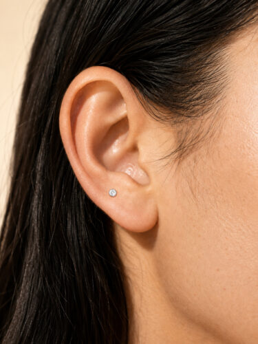 Upper Lobe